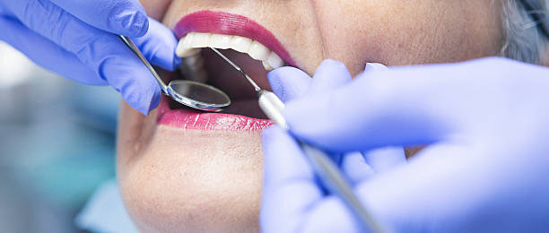 Best Emergency Tooth Extraction in Spencer, WV
